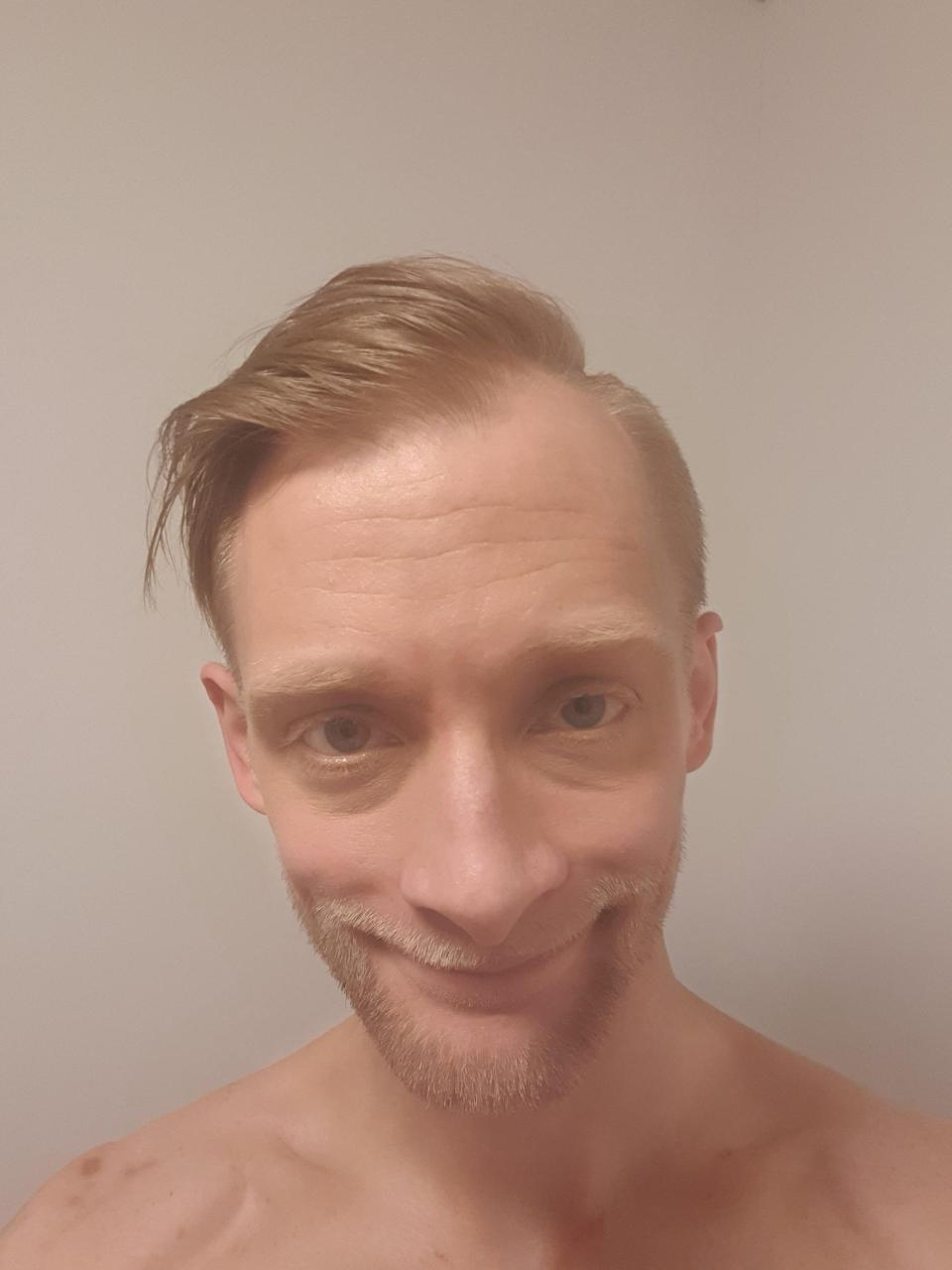 DPFYREN